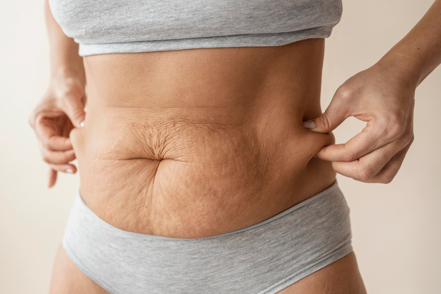 ABDOMINOPLASTIA ABDOMINOPLASTIA