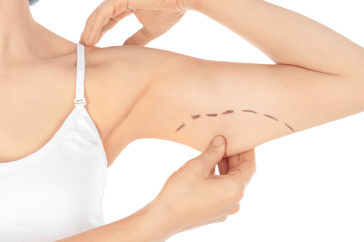 BRAQUIOPLASTIA BRAQUIOPLASTIA